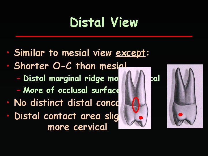 Distal View • Similar to mesial view except: • Shorter O-C than mesial –