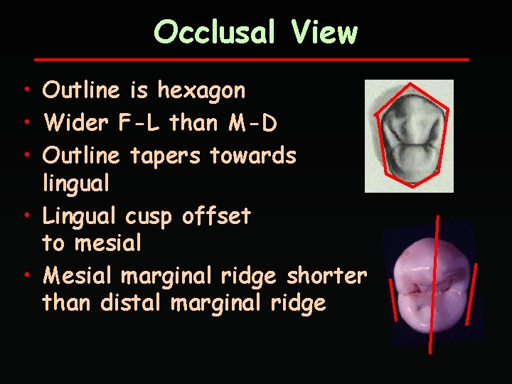 Occlusal View • Outline is hexagon • Wider F-L than M-D • Outline tapers