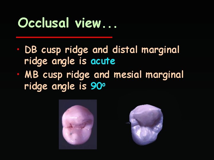 Occlusal view. . . • DB cusp ridge and distal marginal ridge angle is