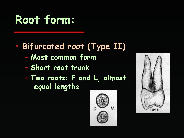 Root form: • Bifurcated root (Type II) – Most common form – Short root