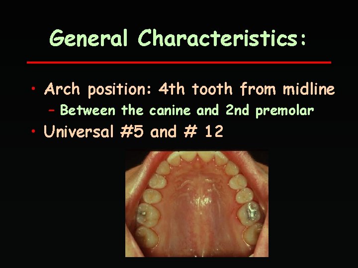 General Characteristics: • Arch position: 4 th tooth from midline – Between the canine
