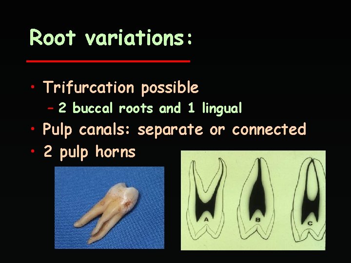 Root variations: • Trifurcation possible – 2 buccal roots and 1 lingual • Pulp