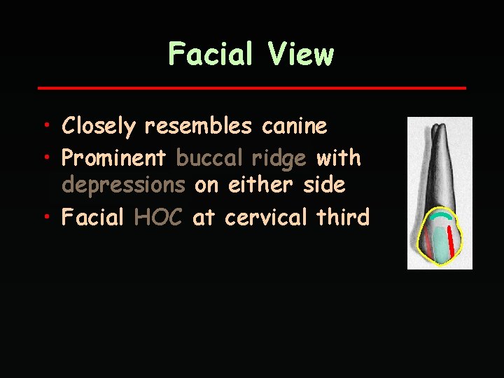 Facial View • Closely resembles canine • Prominent buccal ridge with depressions on either