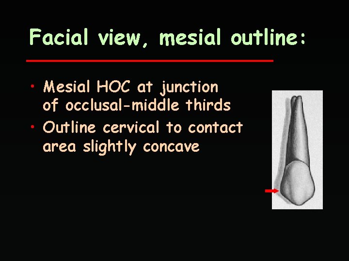 Facial view, mesial outline: • Mesial HOC at junction of occlusal-middle thirds • Outline