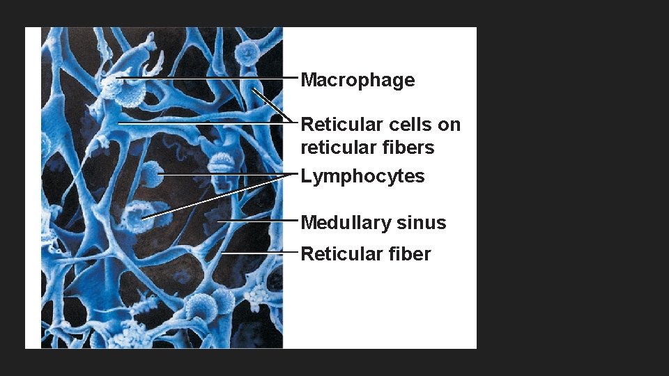 Macrophage Reticular cells on reticular fibers Lymphocytes Medullary sinus Reticular fiber 