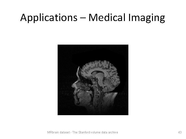 Applications – Medical Imaging MRbrain dataset - The Stanford volume data archive 43 