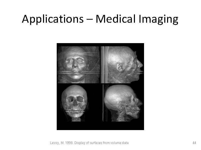 Applications – Medical Imaging Levoy, M. 1998. Display of surfaces from volume data 44