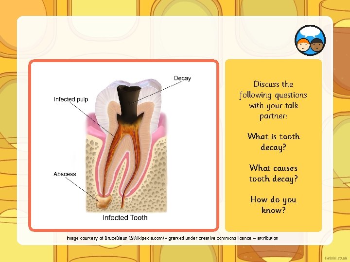 Discuss the following questions with your talk partner: What is tooth decay? What causes