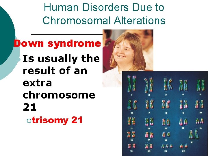 Human Disorders Due to Chromosomal Alterations ¡ Down syndrome l Is usually the result Human Disorders Due to Chromosomal Alterations ¡ Down syndrome l Is usually the result