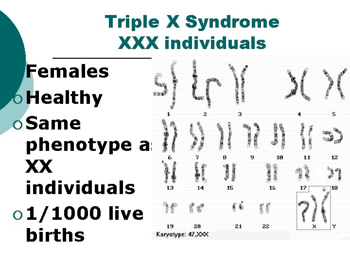 Triple X Syndrome XXX individuals ¡ Females ¡ Healthy ¡ Same phenotype as XX Triple X Syndrome XXX individuals ¡ Females ¡ Healthy ¡ Same phenotype as XX