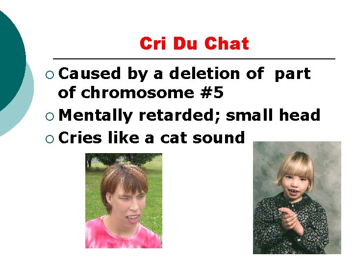 Cri Du Chat ¡ Caused by a deletion of part of chromosome #5 ¡ Cri Du Chat ¡ Caused by a deletion of part of chromosome #5 ¡