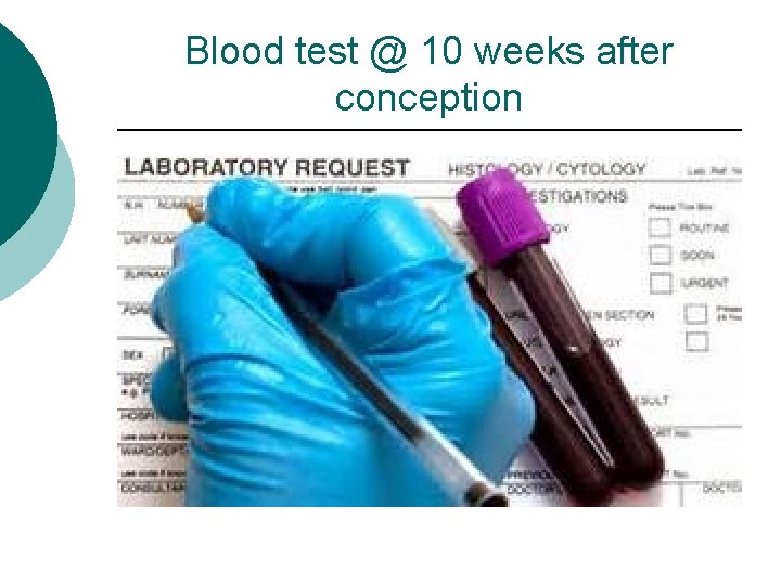 Blood test @ 10 weeks after conception Blood test @ 10 weeks after conception
