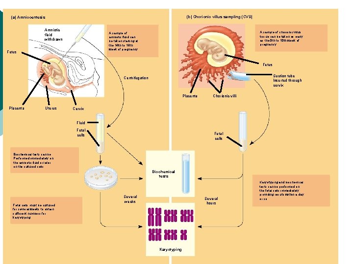 (b) Chorionic villus sampling (CVS) (a) Amniocentesis Amniotic fluid withdrawn A sample of chorionic (b) Chorionic villus sampling (CVS) (a) Amniocentesis Amniotic fluid withdrawn A sample of chorionic