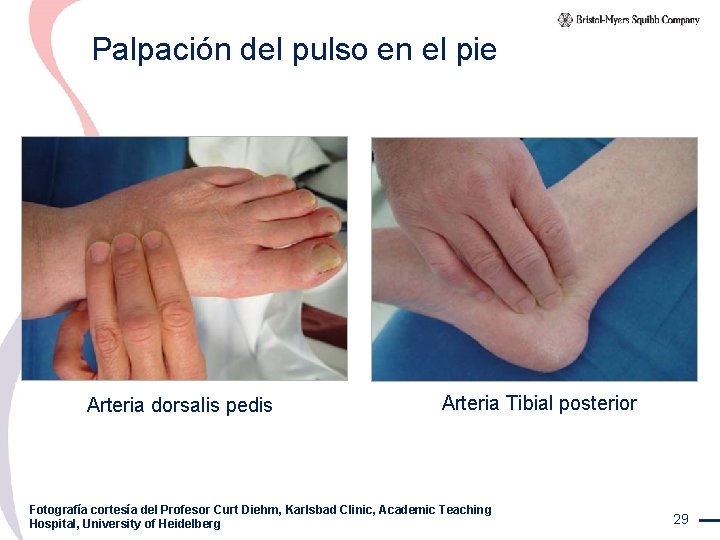 Palpación del pulso en el pie Arteria dorsalis pedis Arteria Tibial posterior Fotografía cortesía