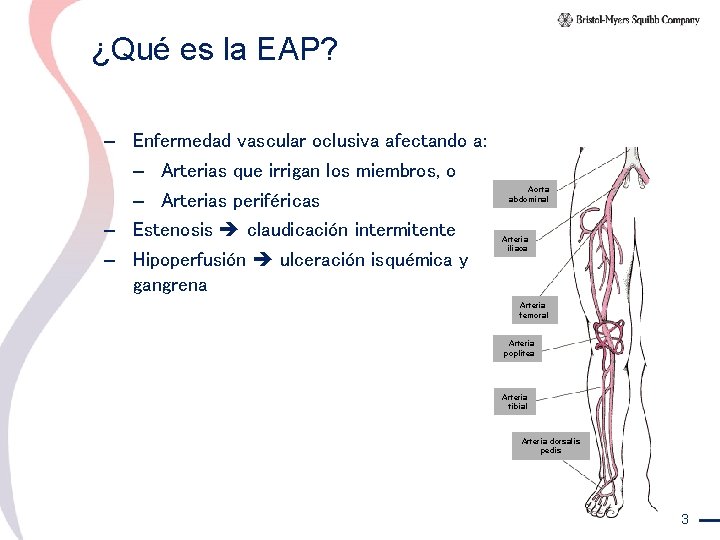 ¿Qué es la EAP? – Enfermedad vascular oclusiva afectando a: – Arterias que irrigan