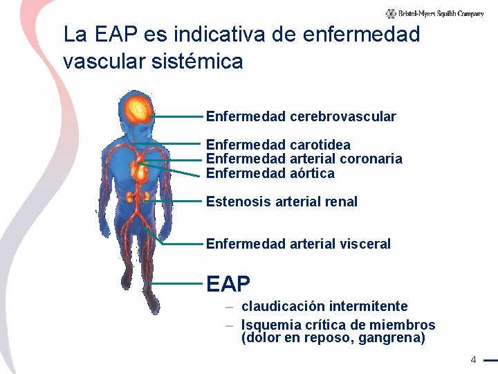 La EAP es indicativa de enfermedad vascular sistémica Enfermedad cerebrovascular Enfermedad carotidea Enfermedad arterial