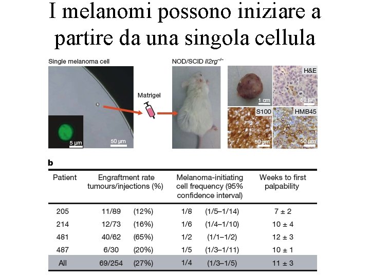 I melanomi possono iniziare a partire da una singola cellula 