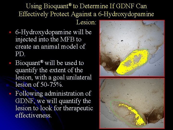 § § § Using Bioquant® to Determine If GDNF Can Effectively Protect Against a