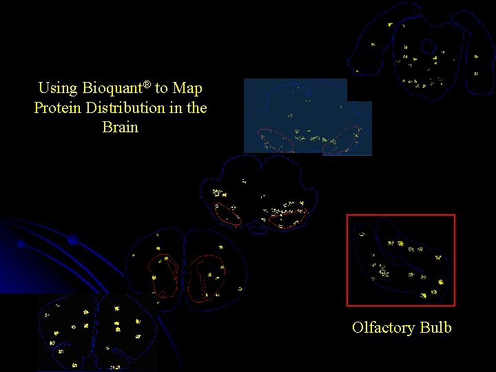 Using Bioquant® to Map Protein Distribution in the Brain Olfactory Bulb 