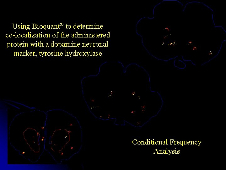 Using Bioquant® to determine co-localization of the administered protein with a dopamine neuronal marker,