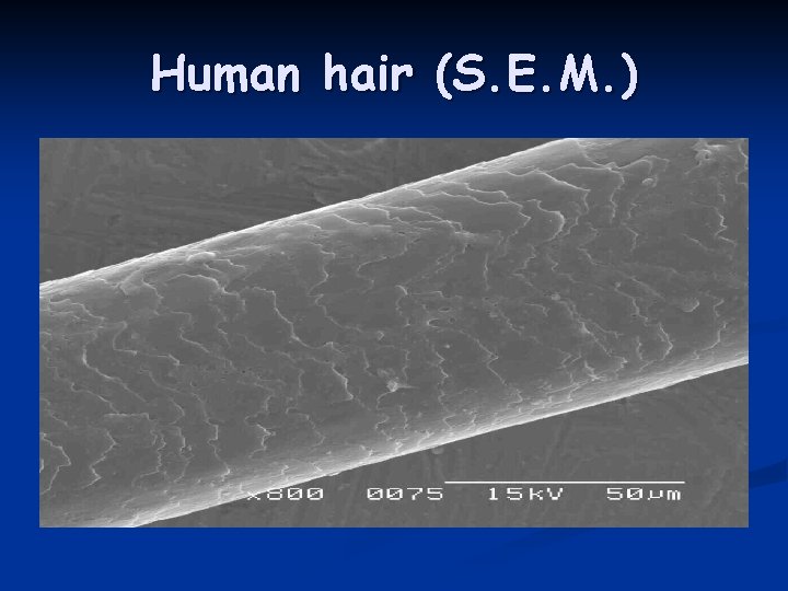 Human hair (S. E. M. ) 