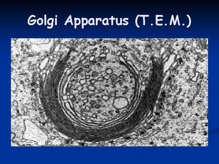 Golgi Apparatus (T. E. M. ) 