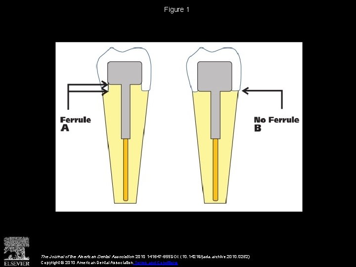 Figure 1 The Journal of the American Dental Association 2010 141647 -655 DOI: (10. Figure 1 The Journal of the American Dental Association 2010 141647 -655 DOI: (10.