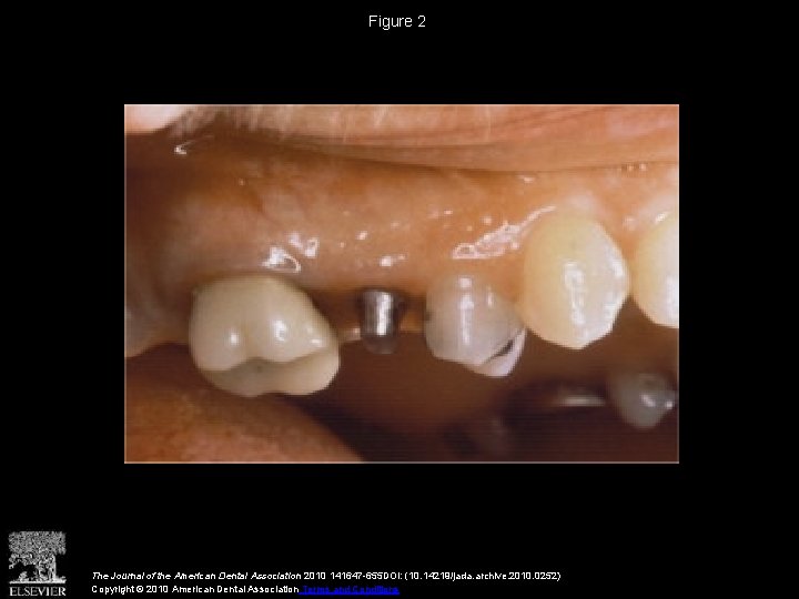 Figure 2 The Journal of the American Dental Association 2010 141647 -655 DOI: (10. Figure 2 The Journal of the American Dental Association 2010 141647 -655 DOI: (10.