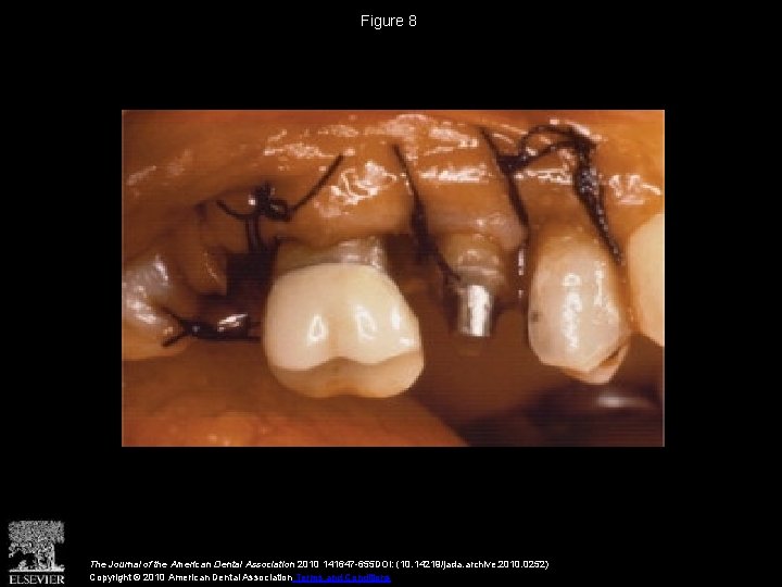 Figure 8 The Journal of the American Dental Association 2010 141647 -655 DOI: (10. Figure 8 The Journal of the American Dental Association 2010 141647 -655 DOI: (10.