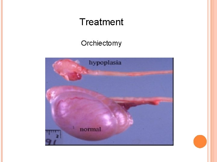 SURGICAL AFFECTION OF MALE GENITAL SYSTEM EVALUATION OF