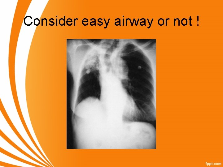 Consider easy airway or not ! 