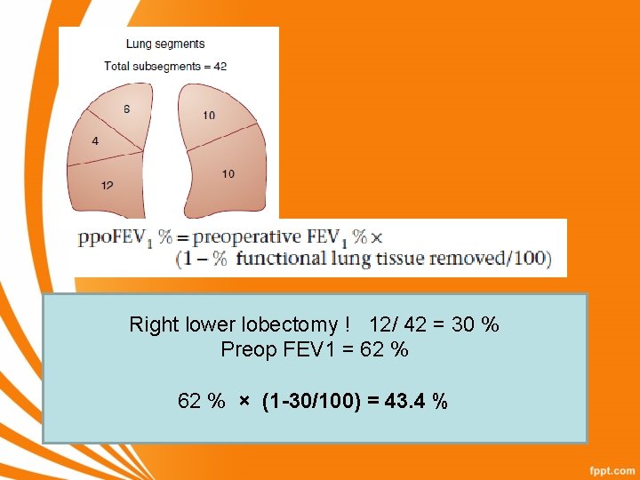 Right lower lobectomy ! 12/ 42 = 30 % Preop FEV 1 = 62