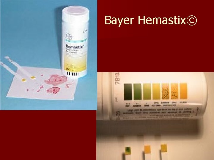 Bayer Hemastix© 