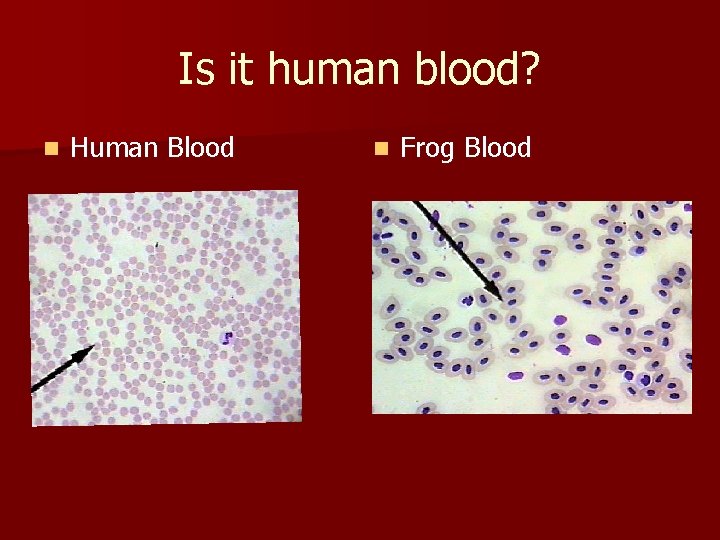 Is it human blood? n Human Blood n Frog Blood 