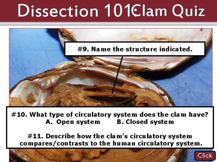 Dissection 101: Clam Quiz #9. Name the structure indicated. #10. What type of circulatory