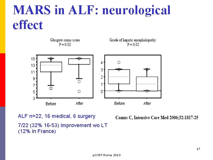 MARS in ALF: neurological effect ALF n=22, 16 medical, 6 surgery 7/22 (32% 16