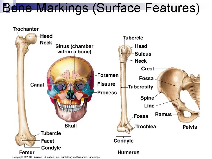 Bone Markings (Surface Features) 