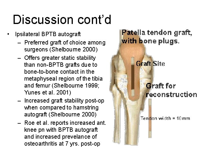 Discussion cont’d • Ipsilateral BPTB autograft – Preferred graft of choice among surgeons (Shelbourne