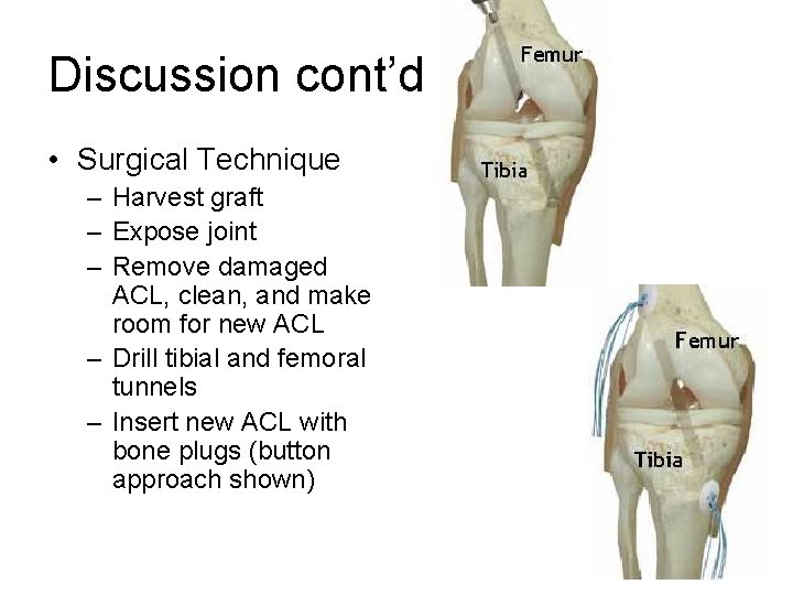 Discussion cont’d • Surgical Technique – Harvest graft – Expose joint – Remove damaged