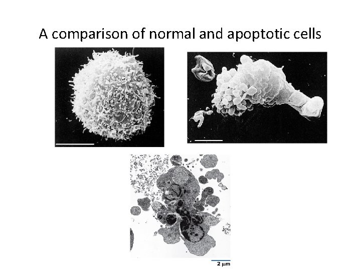 A comparison of normal and apoptotic cells 