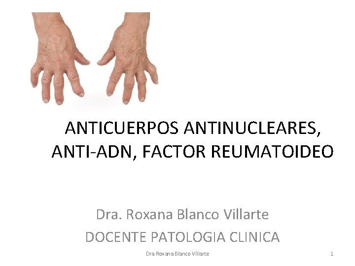 ANTICUERPOS ANTINUCLEARES, ANTI-ADN, FACTOR REUMATOIDEO Dra. Roxana Blanco Villarte DOCENTE PATOLOGIA CLINICA Dra Roxana