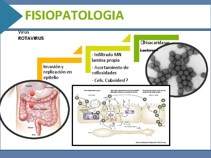 FISIOPATOLOGIA Virus ROTAVIRUS Invasión y replicación en epitelio - Infiltrado MN lamina propia -