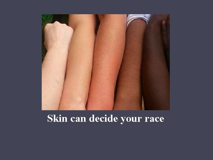 Skin can decide your race 