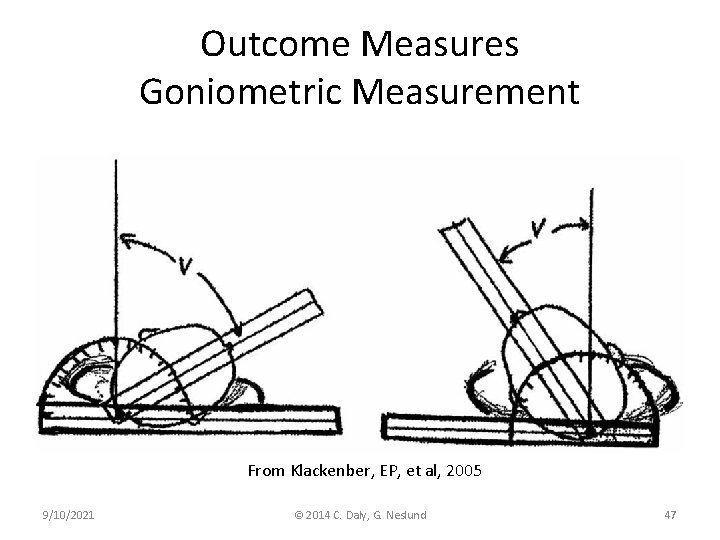 Outcome Measures Goniometric Measurement From Klackenber, EP, et al, 2005 9/10/2021 © 2014 C.