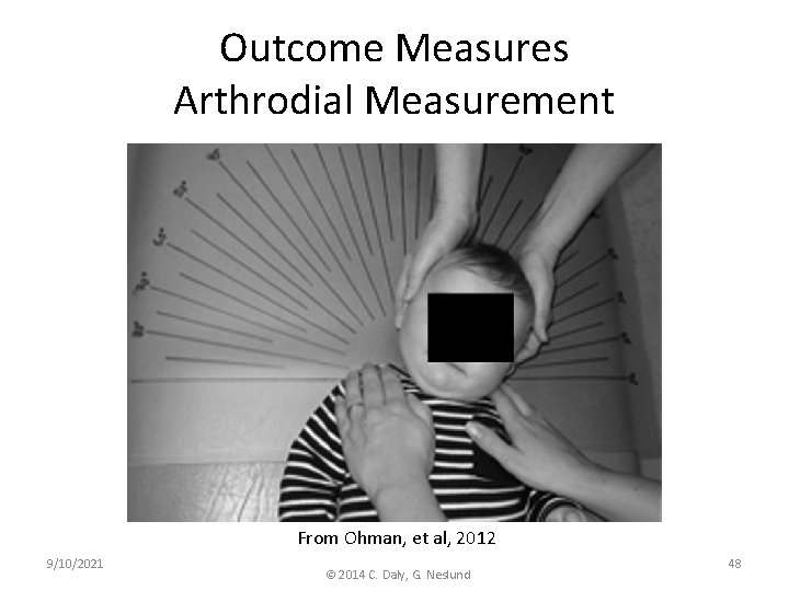 Outcome Measures Arthrodial Measurement From Ohman, et al, 2012 9/10/2021 © 2014 C. Daly,