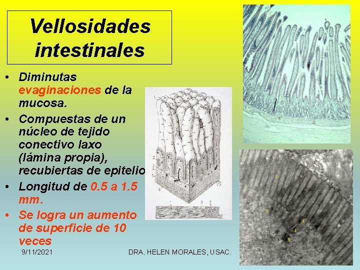 Vellosidades intestinales • Diminutas evaginaciones de la mucosa. • Compuestas de un núcleo de