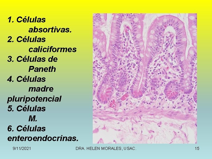 1. Células absortivas. 2. Células caliciformes 3. Células de Paneth 4. Células madre pluripotencial