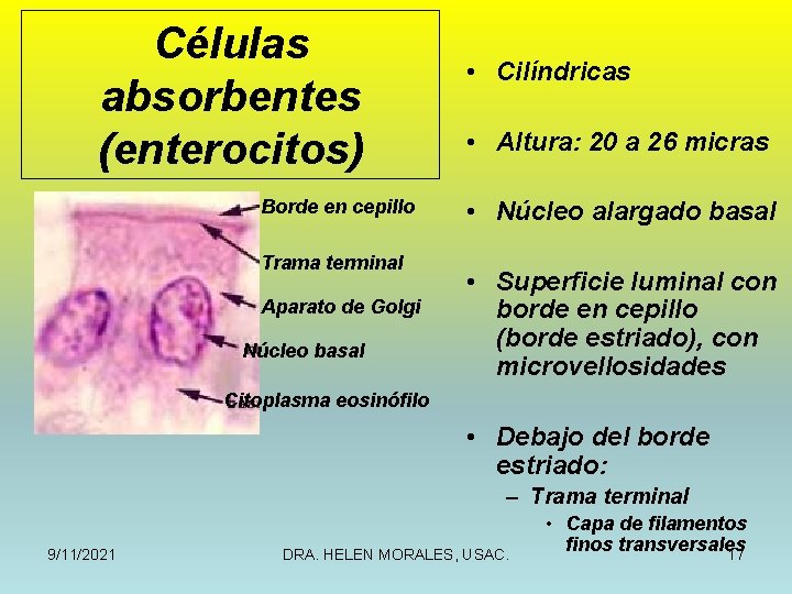 Células absorbentes (enterocitos) Borde en cepillo Trama terminal Aparato de Golgi Núcleo basal •