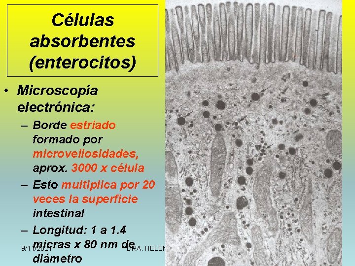 Células absorbentes (enterocitos) • Microscopía electrónica: – Borde estriado formado por microvellosidades, aprox. 3000