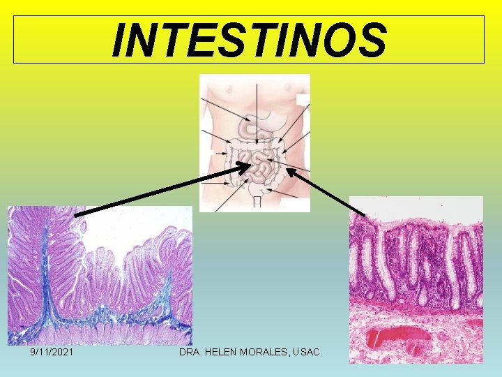 INTESTINOS 9/11/2021 DRA. HELEN MORALES, USAC. 2 